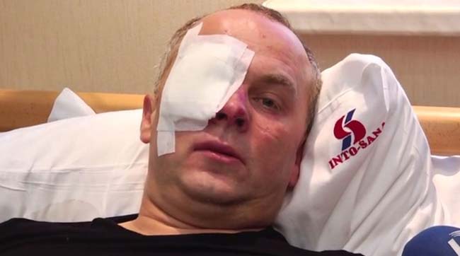 Фото из видеоролика на youtube.com pobitiy shufrich